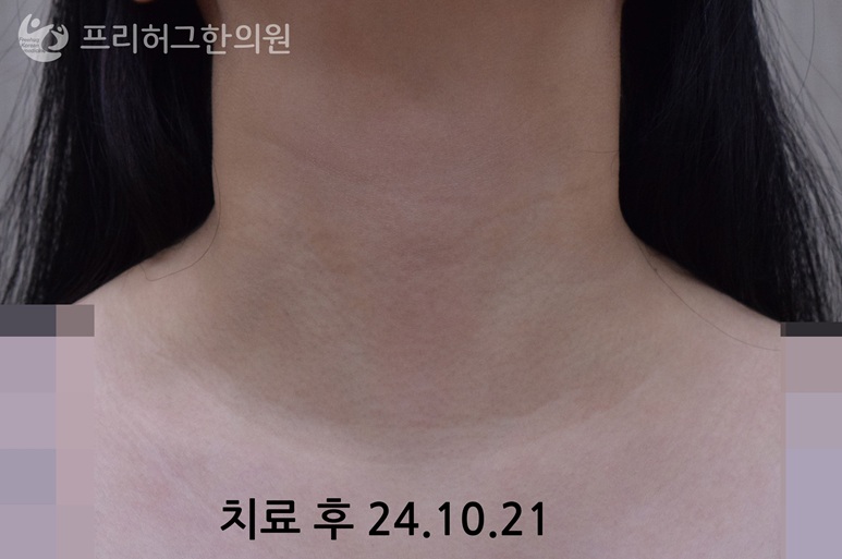 구월동두드러기2_cf079e213b83b67ab14b15d93cf8f5cf.jpg