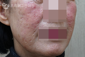 얼굴2_250207_38824cc7ec7ab5dfb01fdbb07a8c8eff.jpg