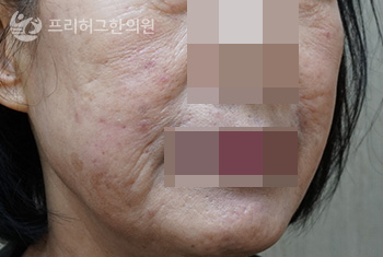 얼굴2_251205_eeee4cd52896f85f55dac393ba818015.jpg
