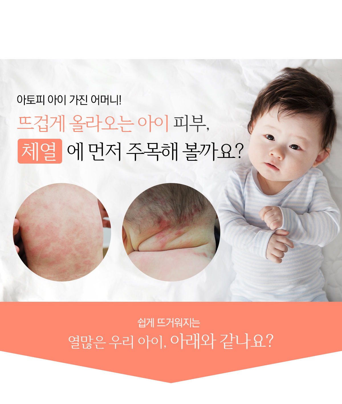 뜨겁게 올라오는 아아 피부, 체열에 먼저 주목해 볼까요?