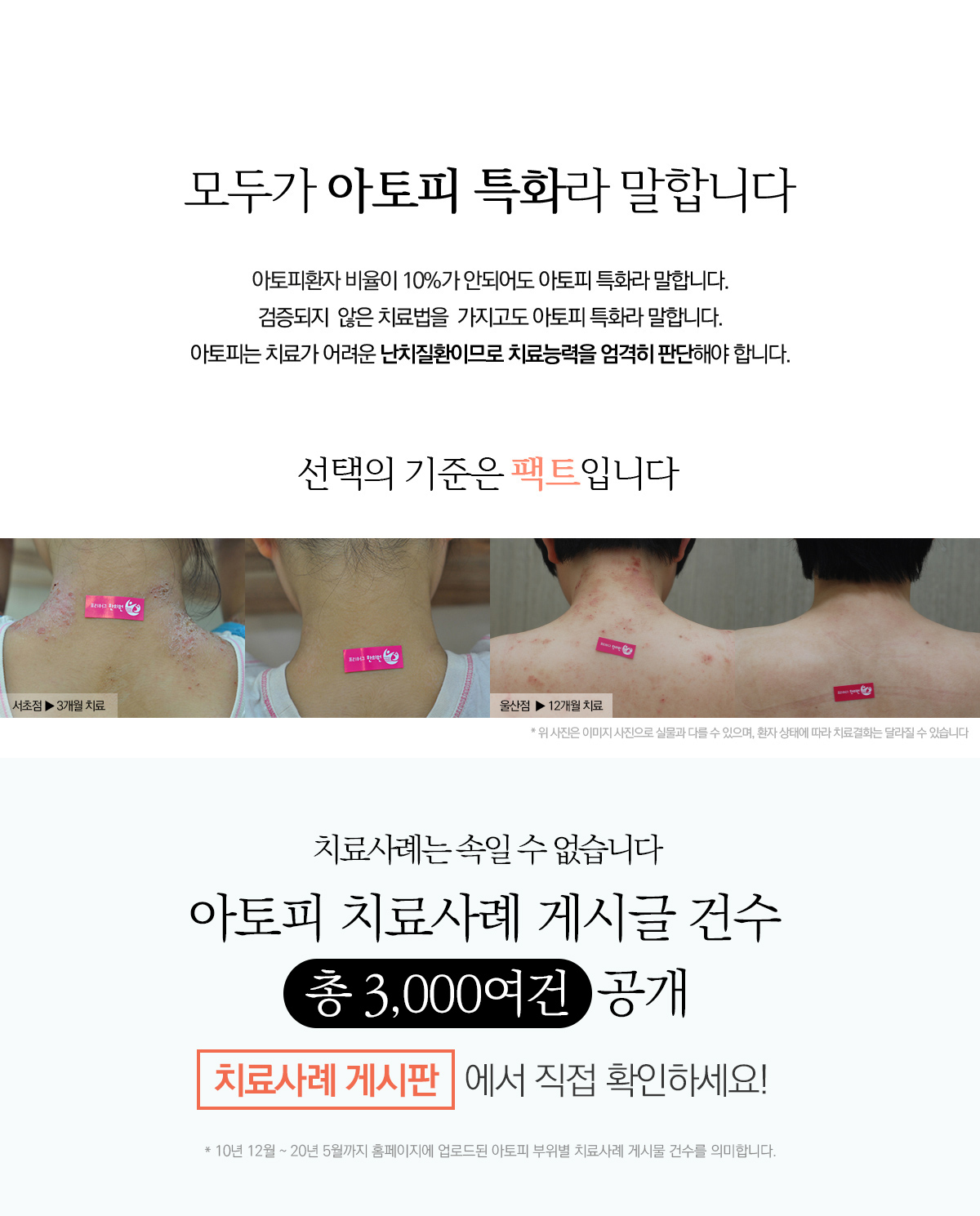 모두가 아토피 특화라 말합니다