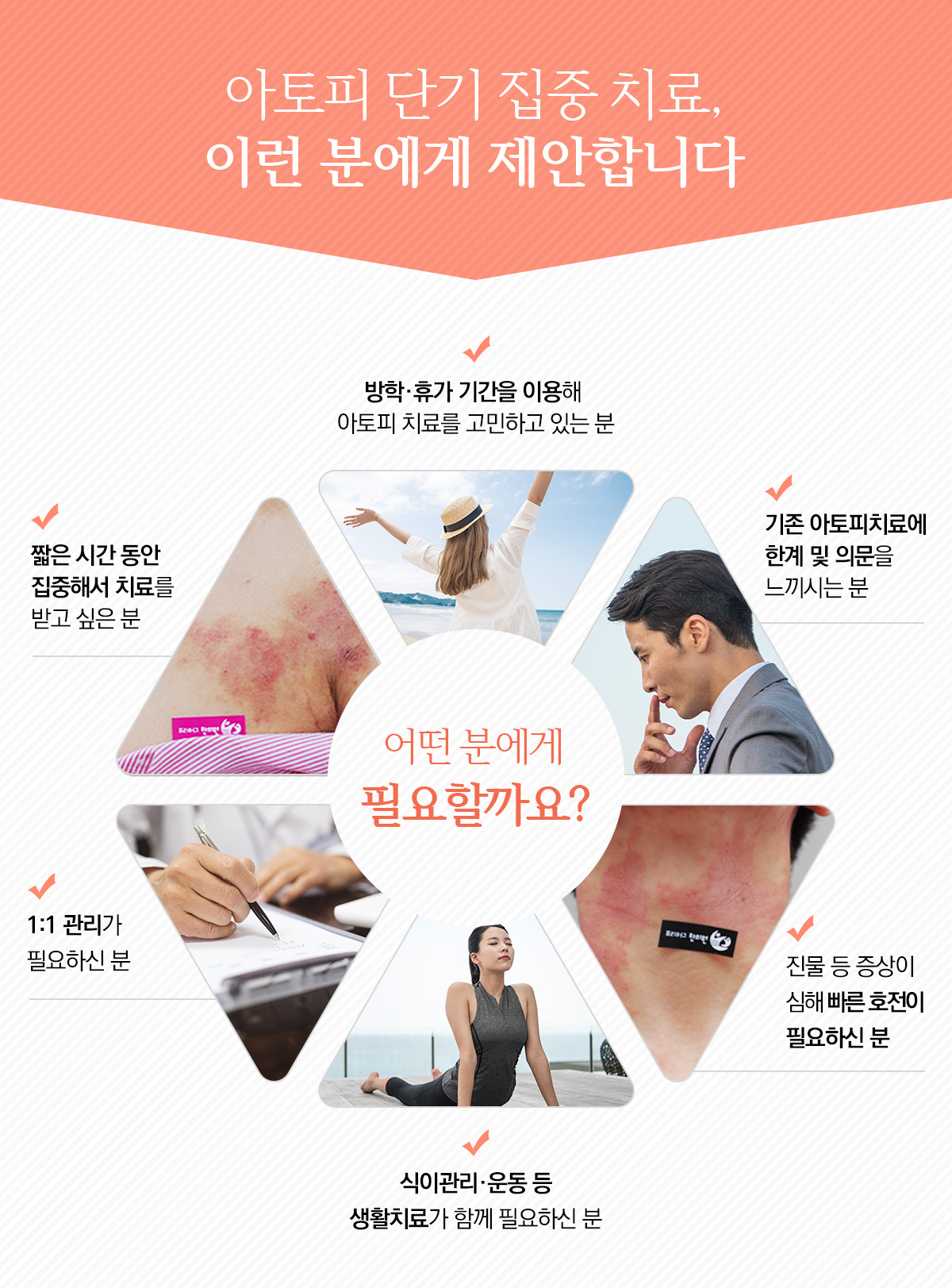 아토피 단기 집중 치료, 이런 분에게 제안합니다