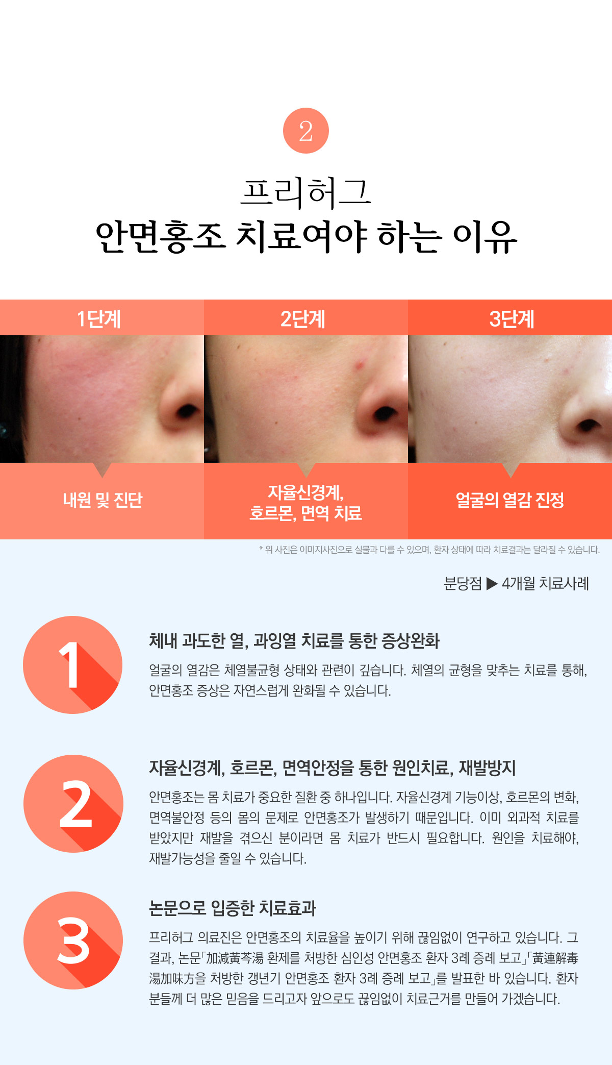 프리허그 안면홍조 치료여야 하는 이유