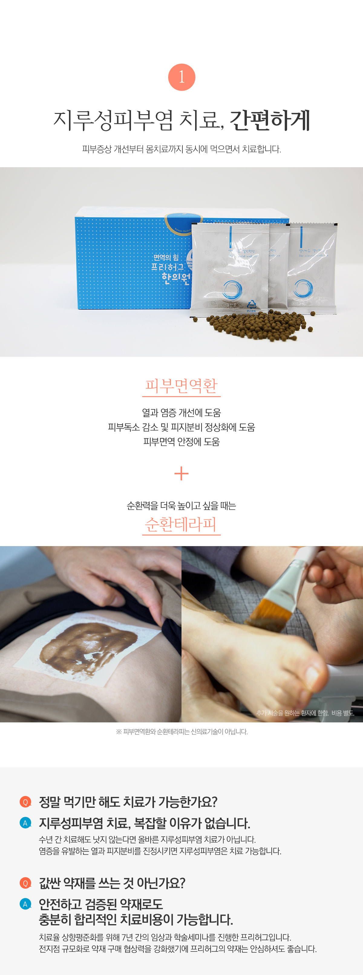 지루성피부염 치료, 간편하게